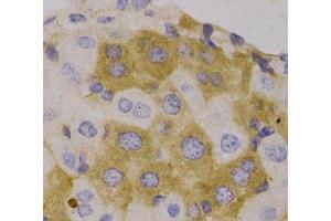 Immunohistochemistry of paraffin-embedded Human liver, using NBR1 Polyclonal Antibody (NBR1 Antikörper)