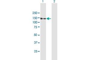 Western Blot analysis of ZFYVE16 expression in transfected 293T cell line by ZFYVE16 MaxPab polyclonal antibody. (ZFYVE16 Antikörper  (AA 1-809))