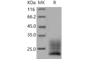 Western Blotting (WB) image for Regenerating Islet-Derived Family, Member 4 (REG4) (Active) protein (His tag) (ABIN7320368) (REG4 Protein (His tag))