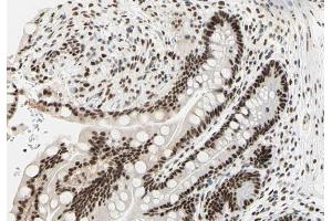 ABIN6266854 at 1/100 staining human colon tissue sections by IHC-P. (PRKDC Antikörper  (Internal Region))