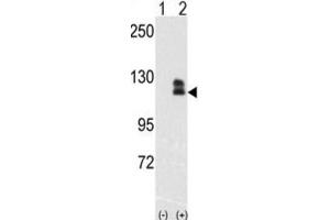 Western Blotting (WB) image for anti-EPH Receptor B2 (EPHB2) antibody (ABIN3003348) (EPH Receptor B2 Antikörper)
