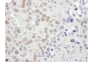 Immunohistochemistry (IHC) image for anti-Mismatch Repair Protein 2 (MSH2) (C-Term) antibody (ABIN7453440) (MSH2 Antikörper  (C-Term))