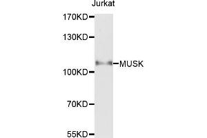 Western blot analysis of extracts of Jurkat cells，using MUSK antibody. (MUSK Antikörper)