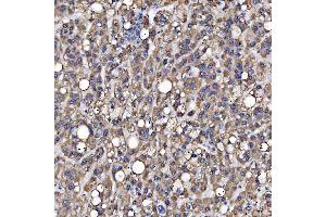 IHC analysis of SARS2 using anti-SARS2 antibody (ABIN7601804).