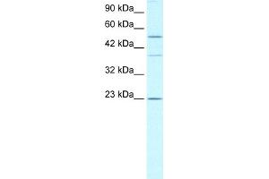 WB Suggested Anti-ZNFN1A1 Antibody Titration:  0. (IKZF1 Antikörper  (Middle Region))