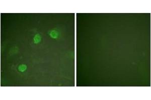 Immunofluorescence analysis of HeLa cells, using GATA3 (Ab-308) Antibody. (GATA3 Antikörper  (AA 274-323))