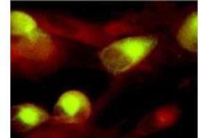 Immunofluorescence (IF) image for anti-CMV gB antibody (ABIN265540)