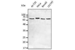 Anti-LMNA Ab at 1/2,500 dilution, lysates at 50 µg per Iane, rabbit polyclinal to goat lgG (HRP) at  1/10,000 dilution,