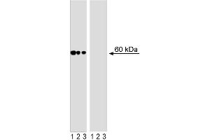 Western blot analysis of AKT (pS473) in human T leukemia. (AKT1 Antikörper  (pSer473))