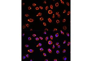 Immunofluorescence (IF) image for anti-Natriuretic Peptides B (NPPB) (AA 1-134) antibody (ABIN3023136)