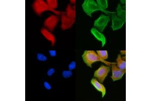 anti-Ribosomal Protein L23 (RPL23) (C-Term) antibody