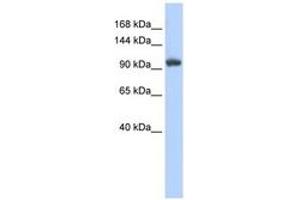 Image no. 1 for anti-Ring Finger Protein 31 (RNF31) (C-Term) antibody (ABIN6740806)