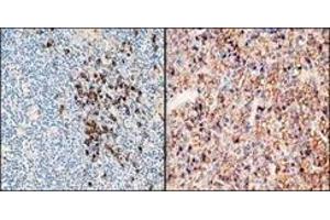 Immunohistochemistry (IHC) image for Rabbit anti-Human Ig (Chain kappa), (Light Chain), (N-Term) antibody (ABIN870362)