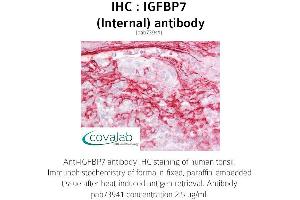 Image no. 2 for anti-Insulin-Like Growth Factor Binding Protein 7 (IGFBP7) (Internal Region) antibody (ABIN1735789) (IGFBP7 Antikörper  (Internal Region))