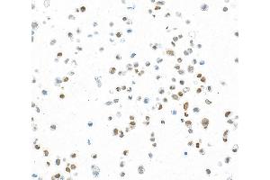 Immunocytochemistry (ICC) image for anti-Forkhead Box Q1 (FOXQ1) (AA 353-403) antibody (ABIN7455177) (Rekombinanter FOXQ1 Antikörper  (AA 353-403))