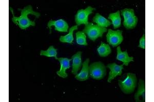 Immunofluorescence staining of A549 cells with ABIN7140106 at 1:50, counter-stained with DAPI. (PPP1R13L Antikörper  (AA 83-102))