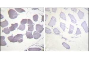 Immunohistochemistry analysis of paraffin-embedded human skeletal muscle, using AMPK beta1 (Phospho-Ser181) Antibody.