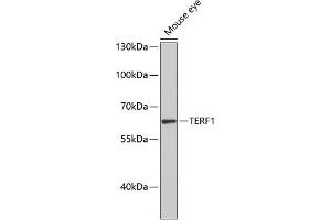 Western blot analysis of extracts of mouse eye, using TERF1 antibody (ABIN1683138, ABIN3015078, ABIN3015079 and ABIN6213631) at 1:1000 dilution. (TRF1 Antikörper  (AA 240-419))