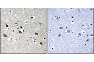 Immunohistochemistry analysis of paraffin-embedded human brain, using SLP-76 (Phospho-Tyr128) Antibody.