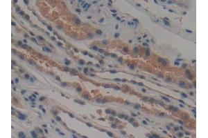 Immunohistochemistry (IHC) image for anti-Mps1 (TTK) (AA 532-786) antibody (ABIN7443260)