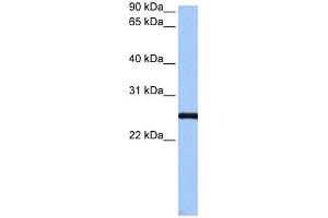 WB Suggested Anti-CCDC46 Antibody Titration: 0. (CCDC46 Antikörper  (C-Term))