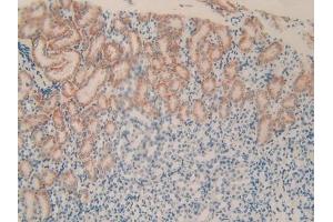Detection of PLXNB1 in Mouse Kidney Tissue using Polyclonal Antibody to Plexin B1 (PLXNB1) (PLXNB1 Antikörper  (AA 1598-1849))