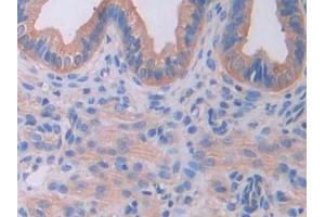 IHC-P analysis of Mouse Uterus Tissue, with DAB staining. (IL18RAP Antikörper  (AA 396-548))