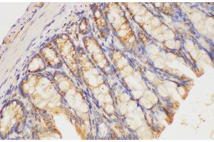 Immunohistochemistry of paraffin-embedded Mouse colon using HRAS Polycloanl Antibody at dilution of 1:200 (HRAS Antikörper)