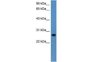 Rat Lung; WB Suggested Anti-Cyb5r2 Antibody Titration: 0. (CYB5R2 Antikörper  (C-Term))