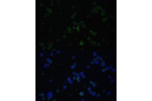 Immunofluorescence analysis of Jurkat cells using CD3D antibody (ABIN3021813, ABIN3021814, ABIN3021815 and ABIN6215992) at dilution of 1:100. (CD3D Antikörper  (AA 22-105))