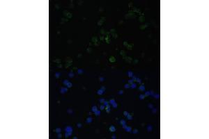 Immunofluorescence analysis of Jurkat cells using CD3D antibody (ABIN3021813, ABIN3021814, ABIN3021815 and ABIN6215992) at dilution of 1:100. (CD3D Antikörper  (AA 22-105))