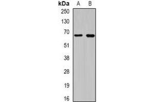 Western blot analysis of CEP57L1 expression in BT474 (A), 22RV1 (B) whole cell lysates. (CEP57L1 Antikörper)
