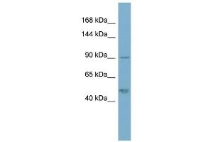 Plakophilin 2 antibody used at 1 ug/ml to detect target protein. (Plakophilin 2 Antikörper  (N-Term))