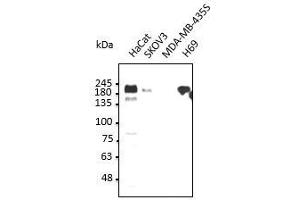 Anti-ERBBI Ab at dilution 1:2,500, 50 µg of total protein per Iane, rabbit polyclonal to goat lgG(HRP) at 1/10,000 dilution, (EGFR Antikörper  (C-Term))