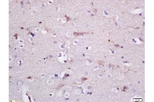 Formalin-fixed and paraffin embedded rat brain labeled with Rabbit Anti-GADD34 Polyclonal Antibody, Unconjugated (ABIN2174278) at 1:200 followed by conjugation to the secondary antibody and DAB staining
