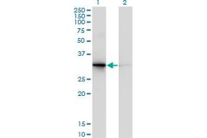 Western Blot analysis of PDYN expression in transfected 293T cell line by PDYN monoclonal antibody (M01), clone 2E12.