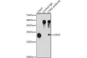 Immunoprecipitation analysis of 900 μg extracts of A-549 cells using 3 μg CDK5 antibody (ABIN6129236, ABIN6138319, ABIN6138320 and ABIN6221397). (CDK5 Antikörper  (AA 1-292))