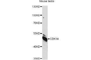 Western blot analysis of extracts of mouse testis, using CDK14 antibody (ABIN6292456) at 1:1000 dilution.