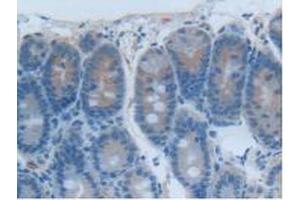 IHC-P analysis of Rat Intestine Tissue, with DAB staining. (CEACAM1 Antikörper  (AA 36-145))