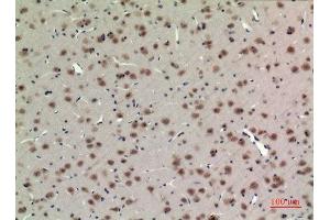 Immunohistochemistry (IHC) image for anti-Aryl Hydrocarbon Receptor Nuclear Translocator-Like (ARNTL) (Lys538) antibody (ABIN3187922)