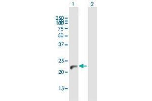 Western Blotting (WB) image for anti-Nudix (Nucleoside Diphosphate Linked Moiety X)-Type Motif 4 (NUDT4) (AA 1-180) antibody (ABIN1989535)