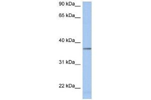 LDHAL6B antibody used at 1 ug/ml to detect target protein. (LDHAL6B Antikörper  (Middle Region))
