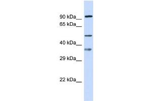 Host: Rabbit Target Name: SGSH Sample Type: 721_B Whole Cell lysates Antibody Dilution: 1. (SGSH Antikörper  (N-Term))