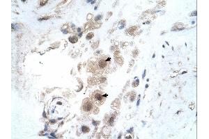 KIAA0494 antibody was used for immunohistochemistry at a concentration of 4-8 ug/ml. (KIAA0494 Antikörper  (N-Term))