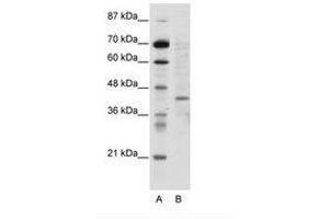 Image no. 1 for anti-Ring Finger Protein 1 (RING1) (N-Term) antibody (ABIN202445)