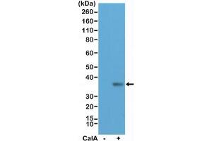 Western blot testing of lysate from human HeLa cells, untreated (-) or treated (+) with Calyculin A (CalA), with recombinant phospho-EIF2A antibody at 1:200 dilution. (Rekombinanter EIF2A Antikörper  (pSer51))