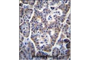 TP53INP1 Antibody (C-term) (ABIN655833 and ABIN2845249) immunohistochemistry analysis in formalin fixed and paraffin embedded human pancreas tissue followed by peroxidase conjugation of the secondary antibody and DAB staining.