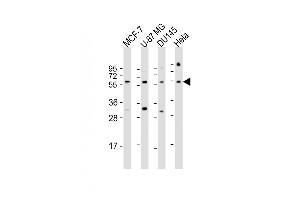 All lanes : Anti-RGS3 Antibody (N-Term) at 1:1000 dilution Lane 1: MCF-7 whole cell lysate Lane 2: U-87 MG whole cell lysate Lane 3: D whole cell lysate Lane 4: Hela whole cell lysate Lysates/proteins at 20 μg per lane. (RGS3 Antikörper  (AA 273-307))