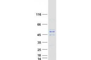 Western Blotting (WB) image for GTP Binding Protein 5 (GTPBP5) protein (Myc-DYKDDDDK Tag) (ABIN2722361)