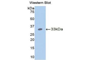 Western Blotting (WB) image for anti-Angiopoietin-Like 4 (ANGPTL4) (AA 183-401) antibody (ABIN3207380) (ANGPTL4 Antikörper  (AA 183-401))